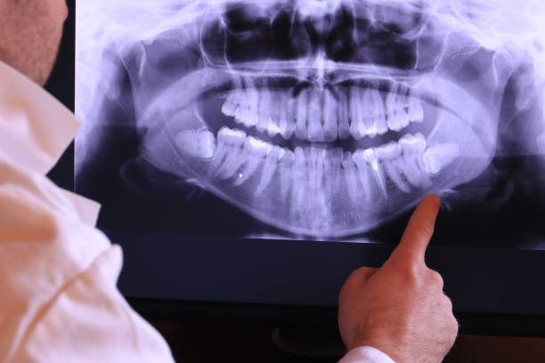 Best Cracked Tooth Emergency Dentist  in Mukilteo, WA