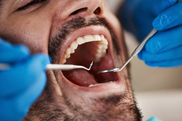 Best Dentist for Dental Trauma  in Mukilteo, WA